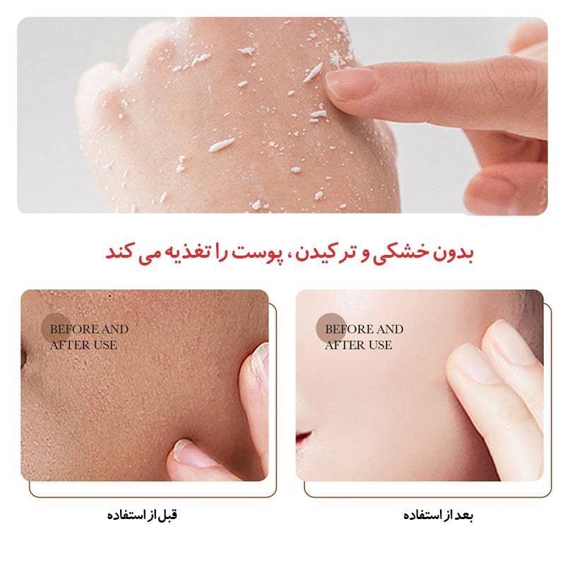 ماسک برنج بیوآکوا